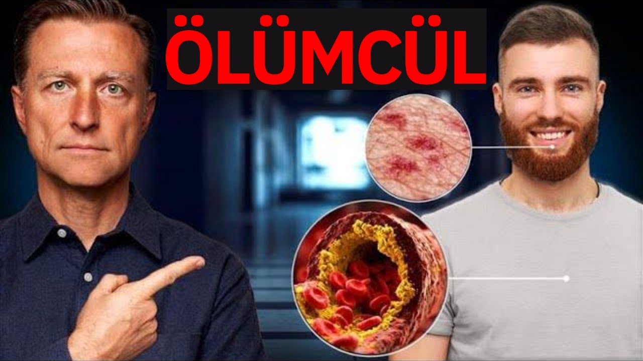 Belirti G&ouml;stermeyen En Tehlikeli Hastalıklar | Dr. Berg T&uuml;rk&ccedil;e