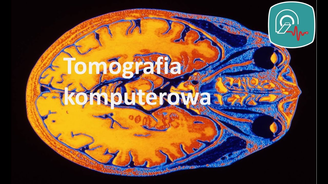 Tomografia komputerowa