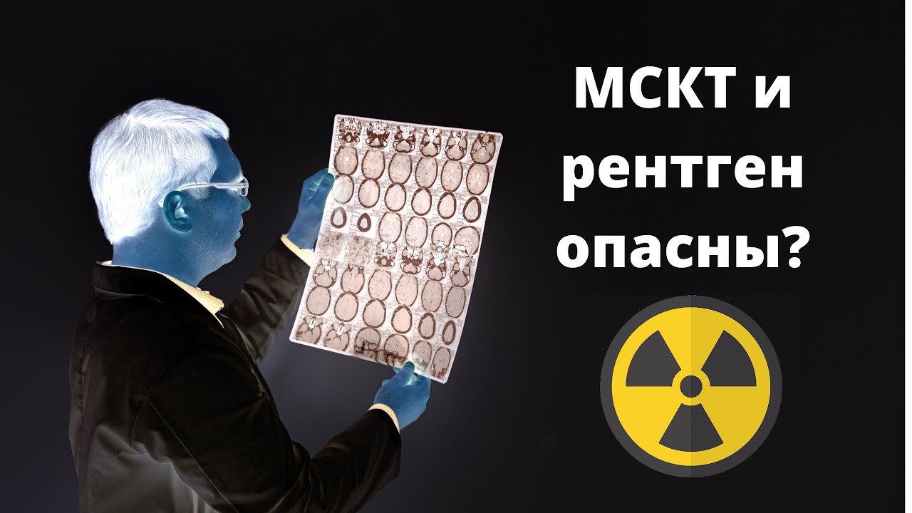 Опасны ли МСКТ и рентген?
