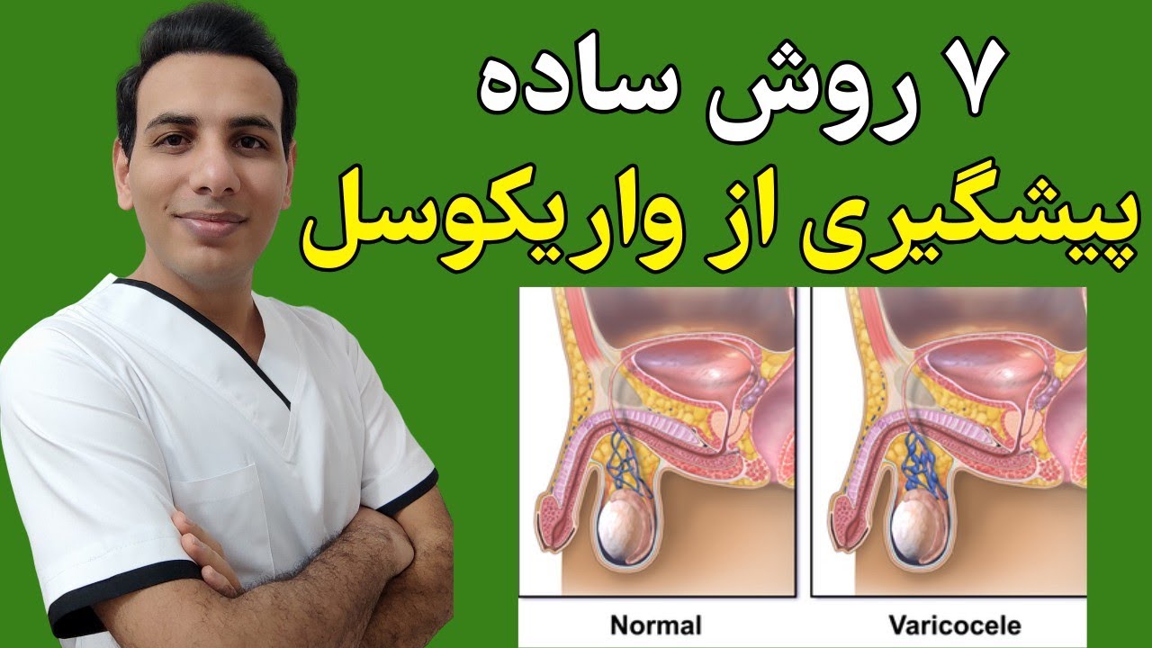 7 روش جلوگیری از واریکوسل (روش های ساده و بی هزینه)