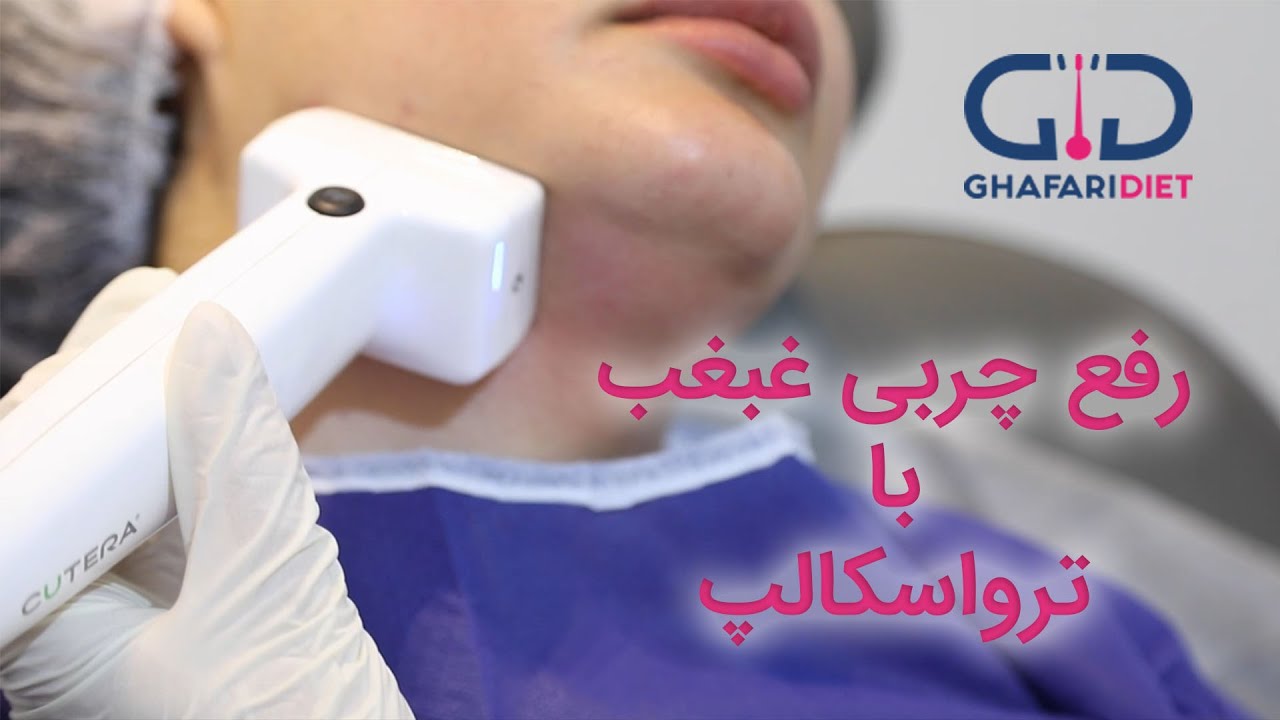 لاغری غبغب با ترواسکالپ