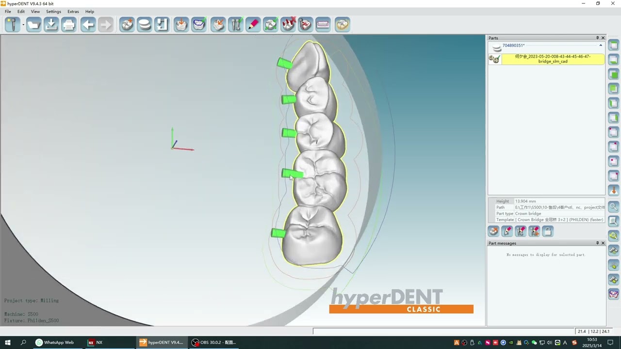 hyperdent 90°milling nesting