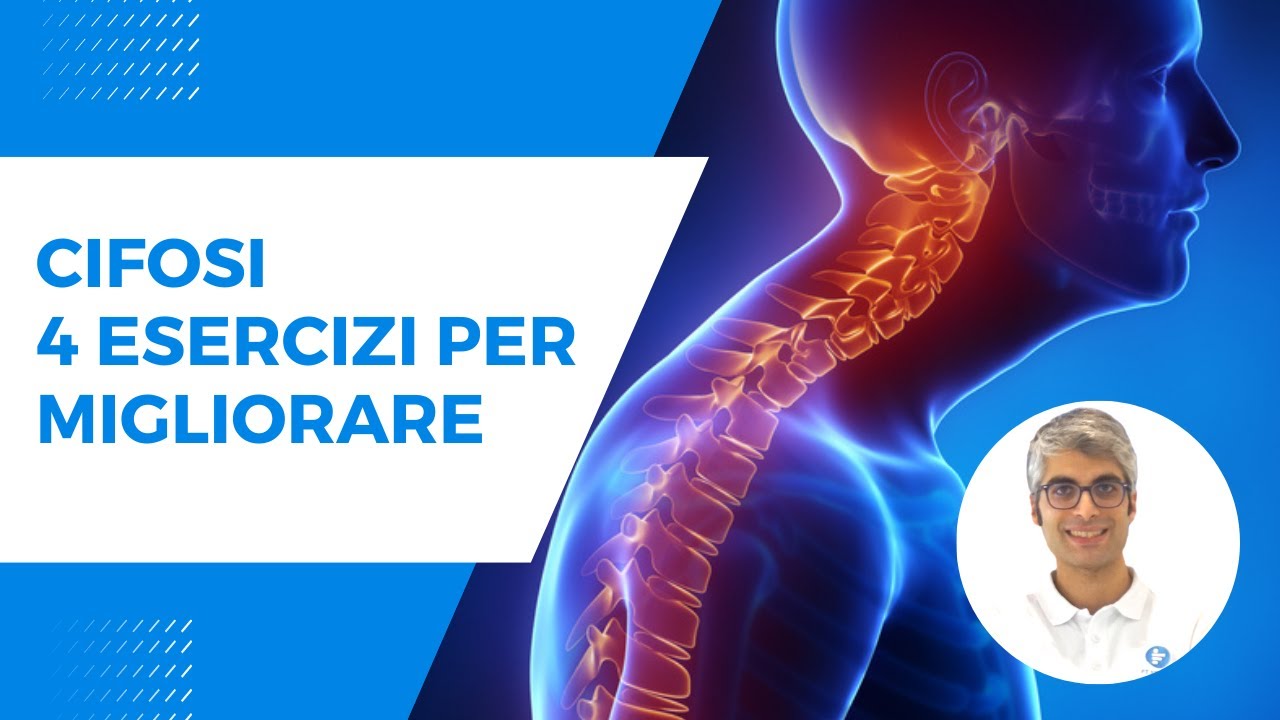 CIFOSI, 4 ESERCIZI PER MIGLIORARE - CONTRATTURE E POSTURA
