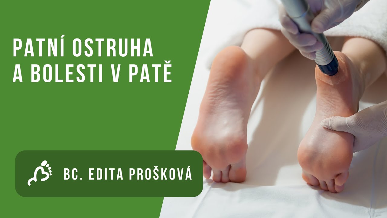 Bc. Edita Prošková: Patní ostruha a bolesti v oblasti paty