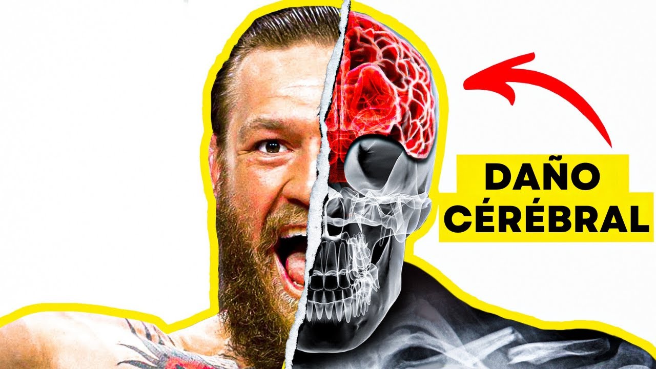 L’Épidémie Silencieuse de Lésions Cérébrales à l’UFC (CTE)