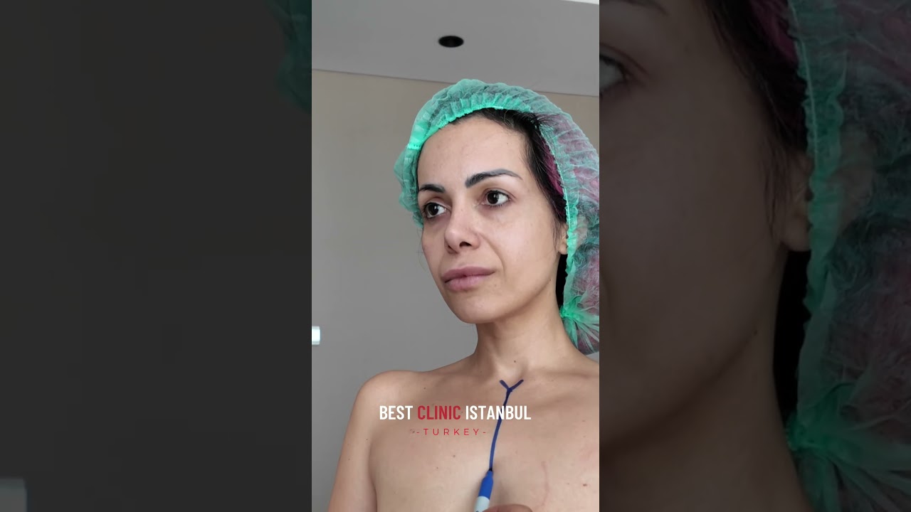 VIP Surgery Day | Breast Lift & Implant Marking Session at Best Clinic Istanbul 💎 