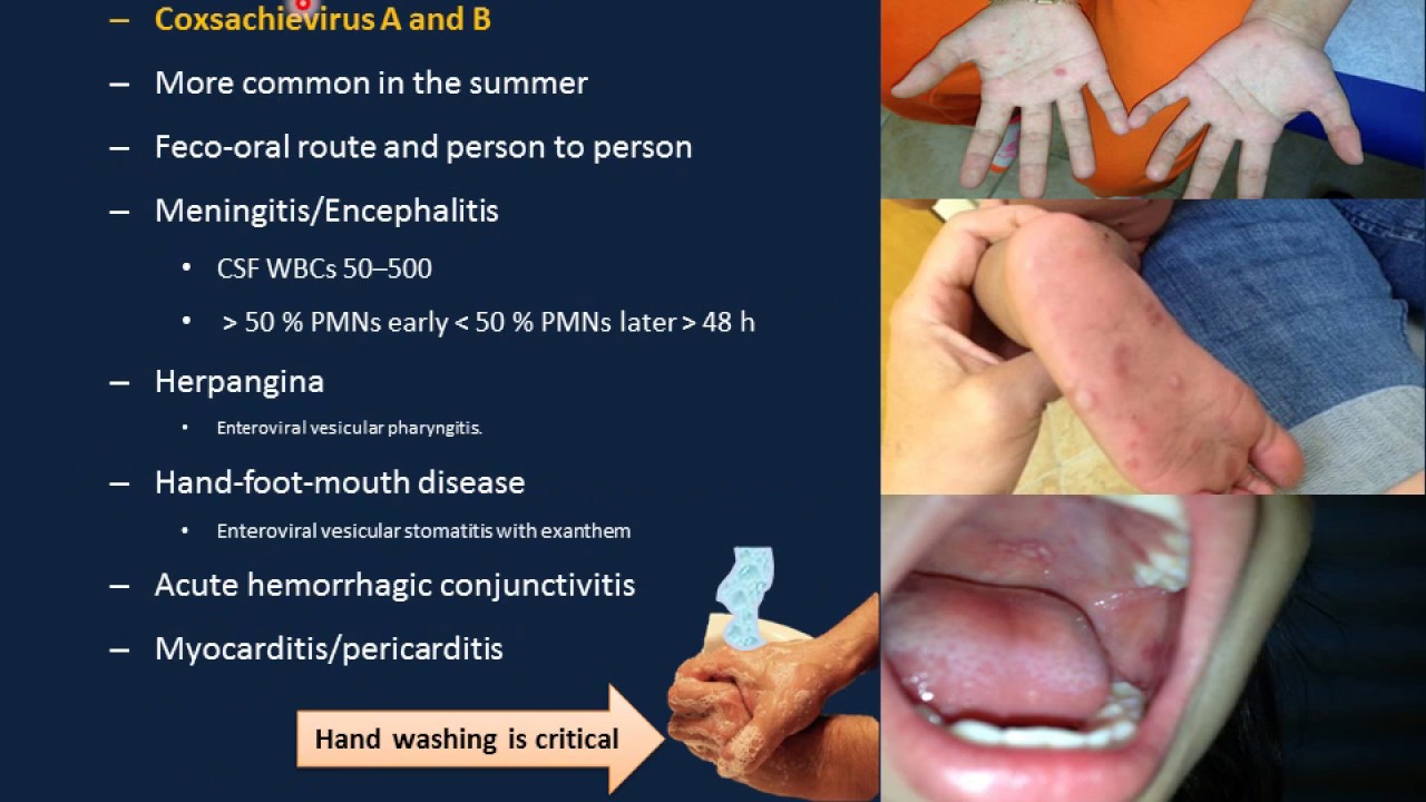 Viral Infections - Infectious Diseases IV