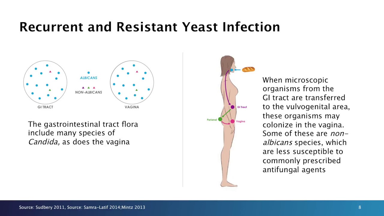 Resistance in Vulvovaginal Candidiasis (VVC)—A Growing Problem
