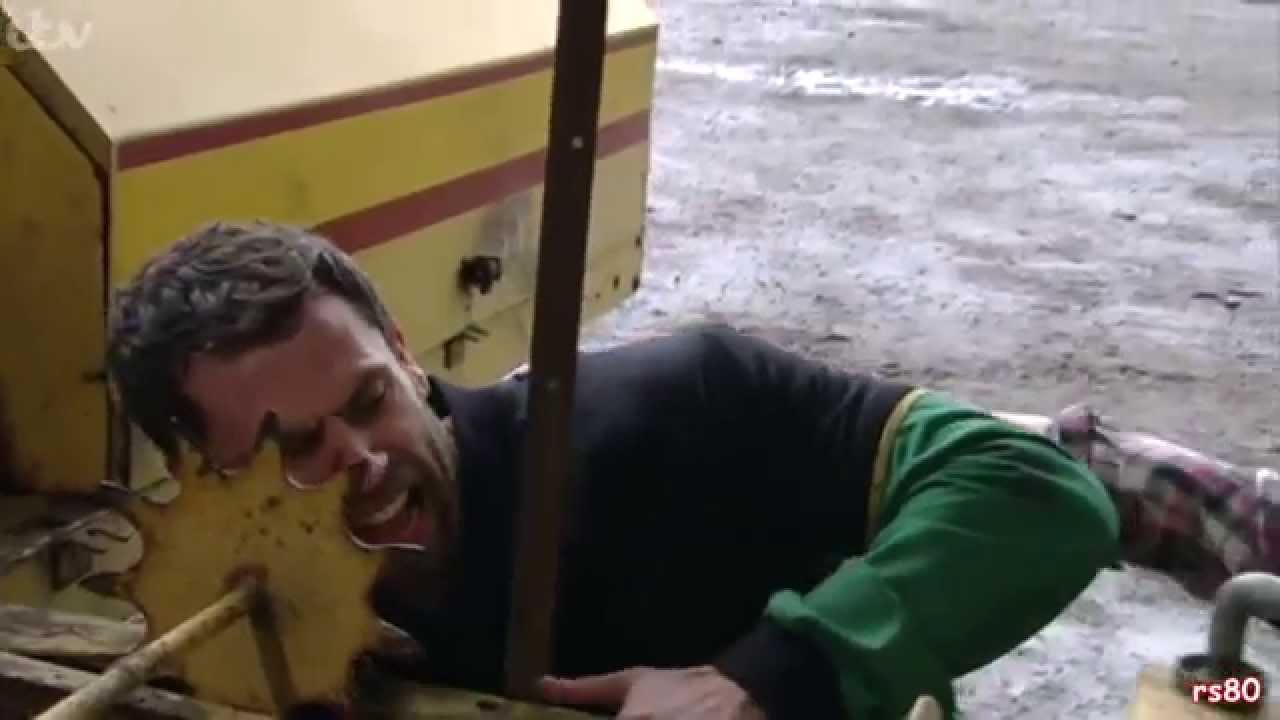 Emmerdale - Andy Gets His Hand Trapped in The Hay Baler