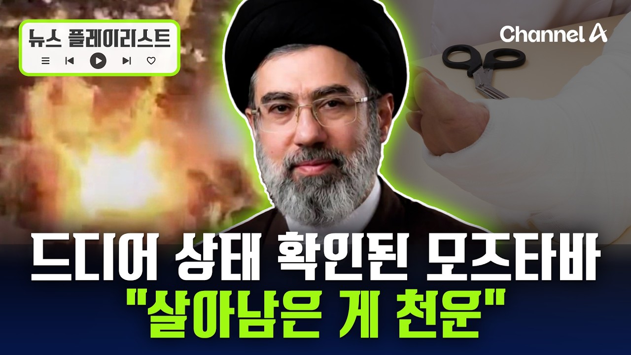 모즈타바, 왜 안 나오나 했더니 얼굴 다치고 발 골절... 