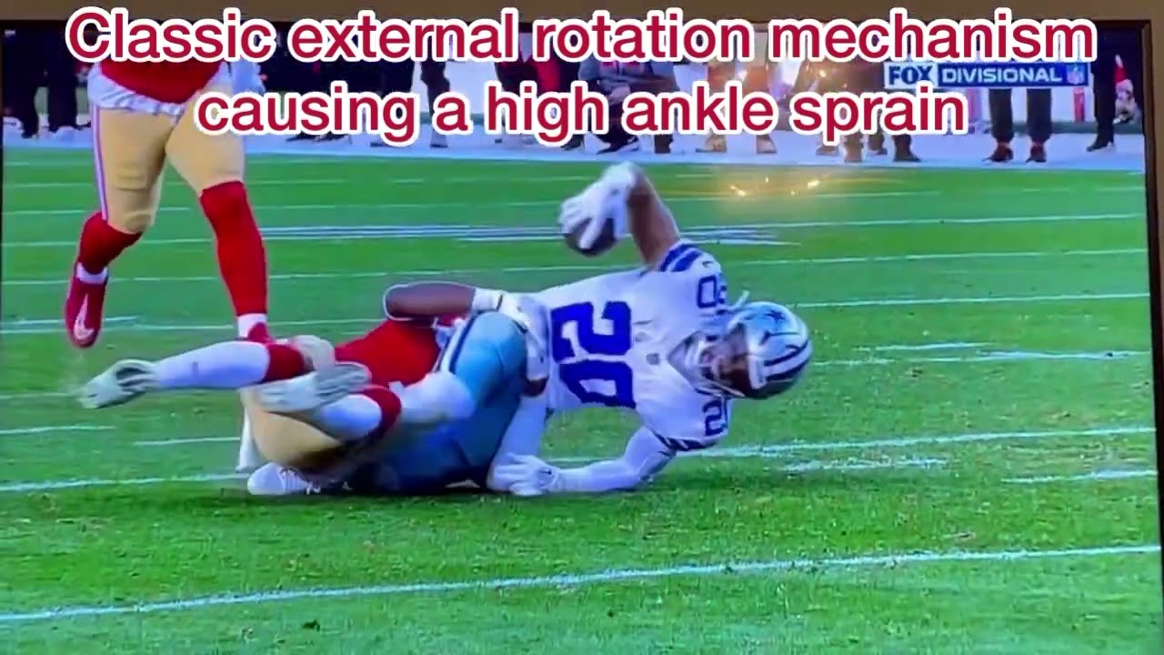 Dallas Cowboys Update: Tony Pollard's Ankle Injury Details | Dr. Sarang Desai