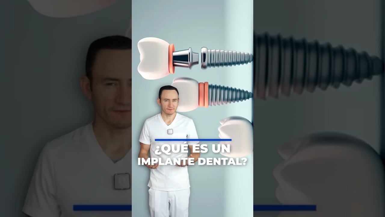&iquest;Qu&eacute; es un implante dental? Te lo explico en un minuto.