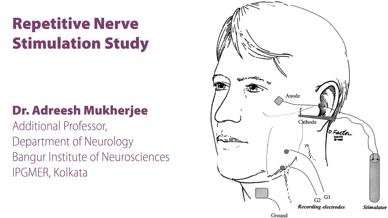 Repetitive Nerve Stimulation Study