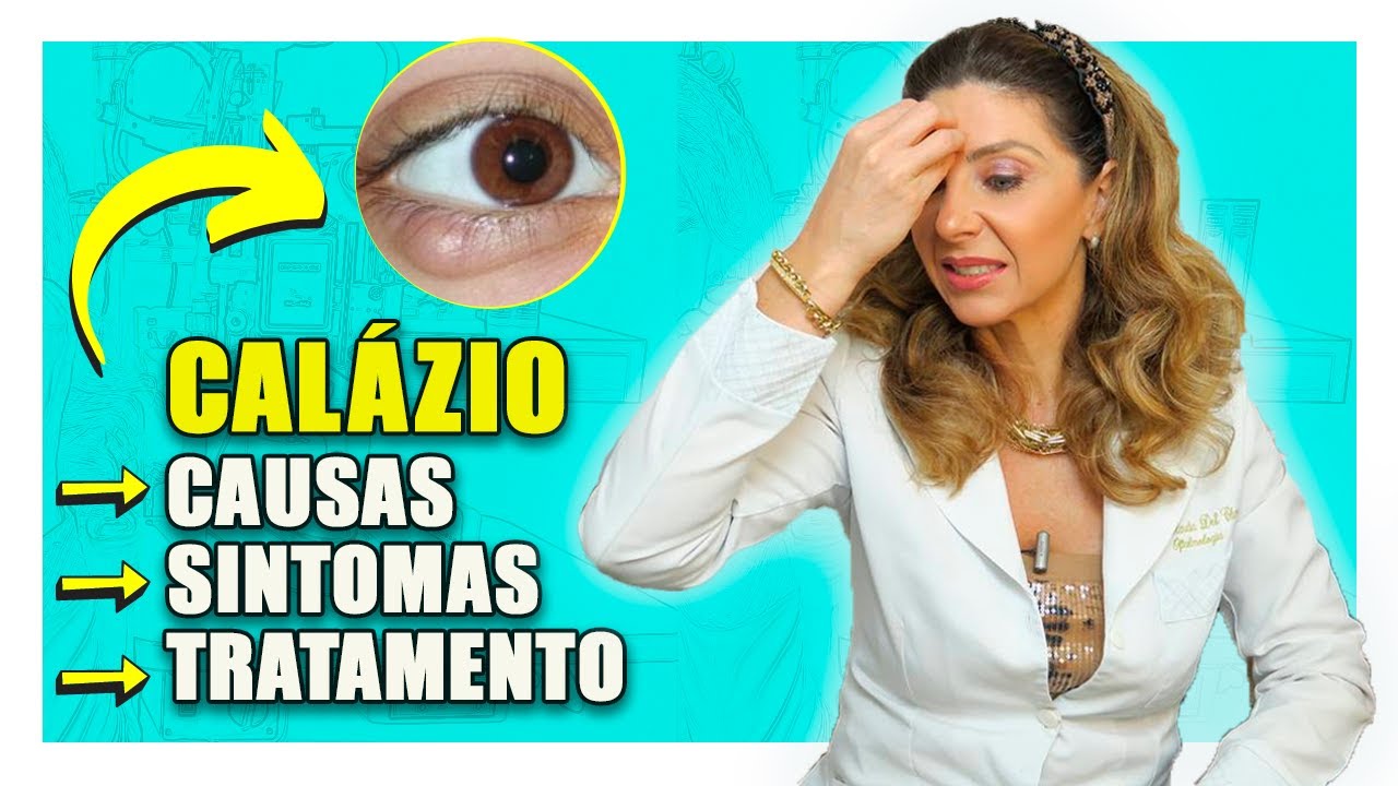 Calázio - Causas, Sintomas e Como Tratar Calázio