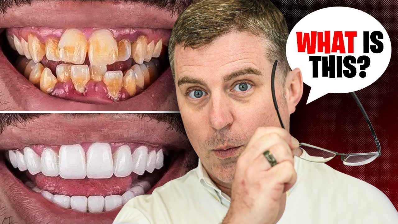 A Cosmetic Dentist’s Guide to Fixing Crooked Teeth