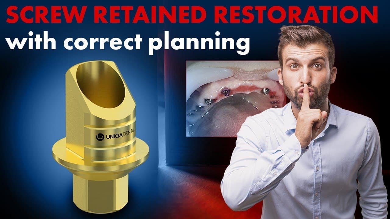 We made a temporary bridge right on top of the implant. Screw retained restoration with planning