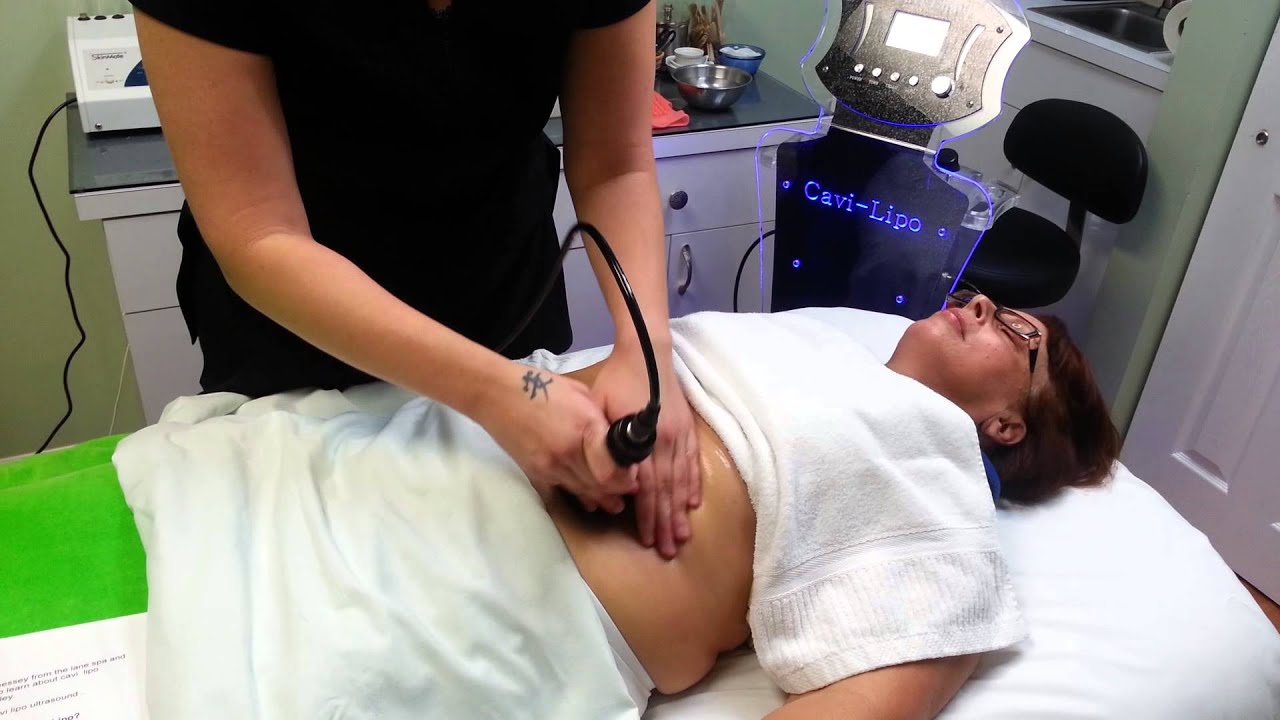 Cavi lipo Ultrasound