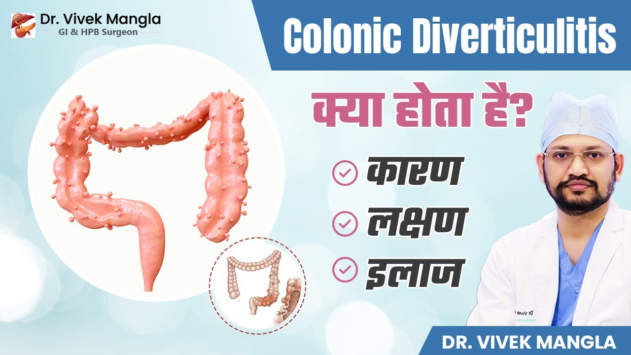 Colonic Diverticulitis क्या है और क्यों होता है? | Colonic Diverticulitis के लक्षण,कारण और इलाज