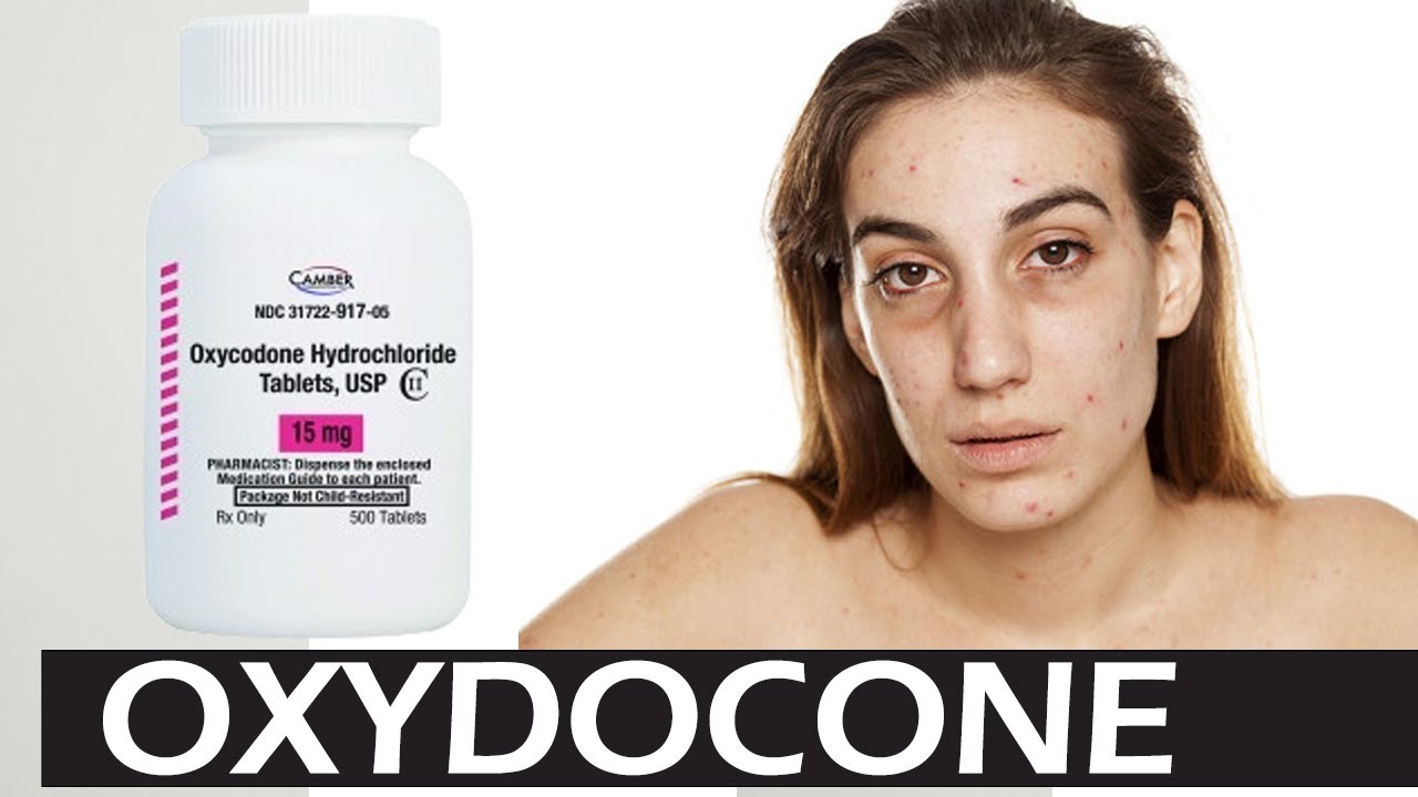 Oxycodone Vs Oxycontin - Opioid side effects