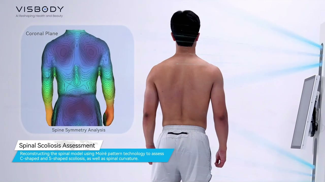 Visbody R60 3D Spine&Posture Assessment Body Scanner