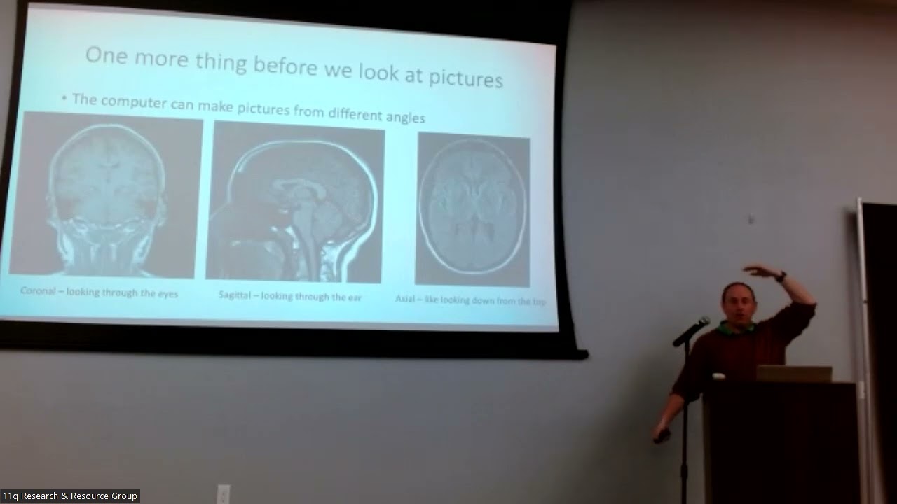 Neurological Issues in 11q Disorders