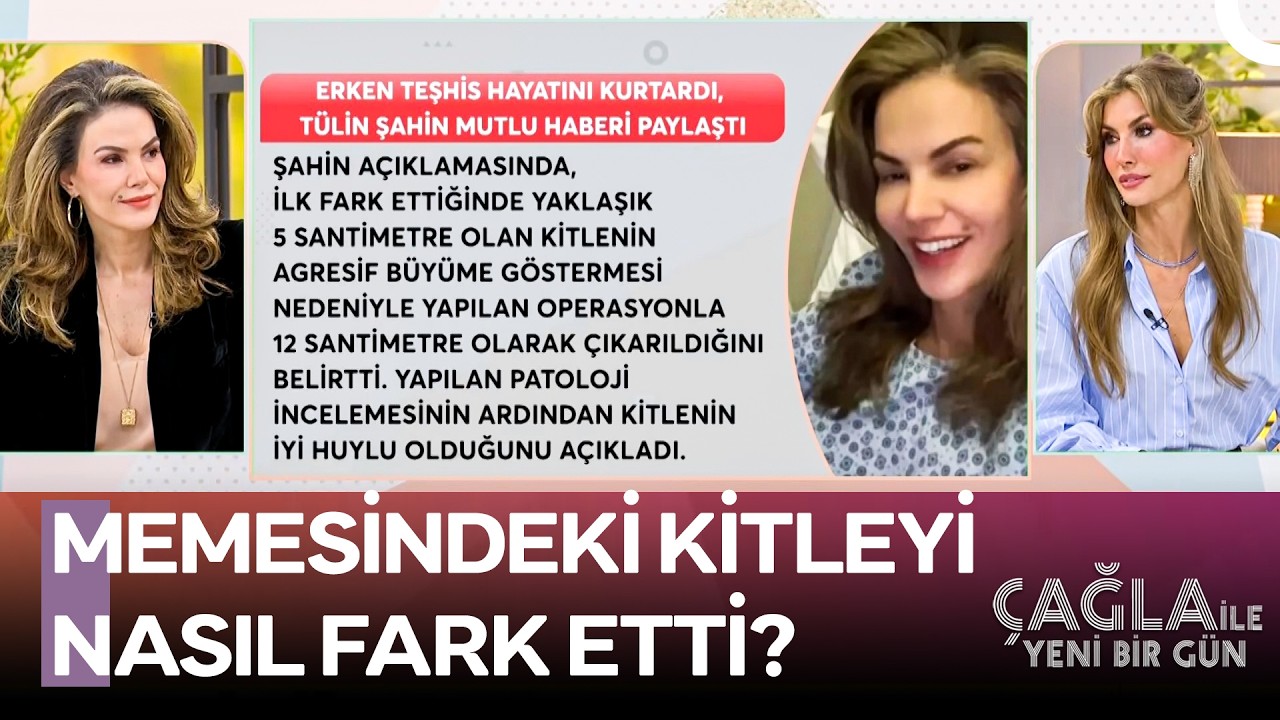 T&uuml;lin Şahin Ameliyat S&uuml;recini İlk Kez Anlatıyor! - &Ccedil;ağla ile Yeni Bir G&uuml;n 1613. B&ouml;l&uuml;m