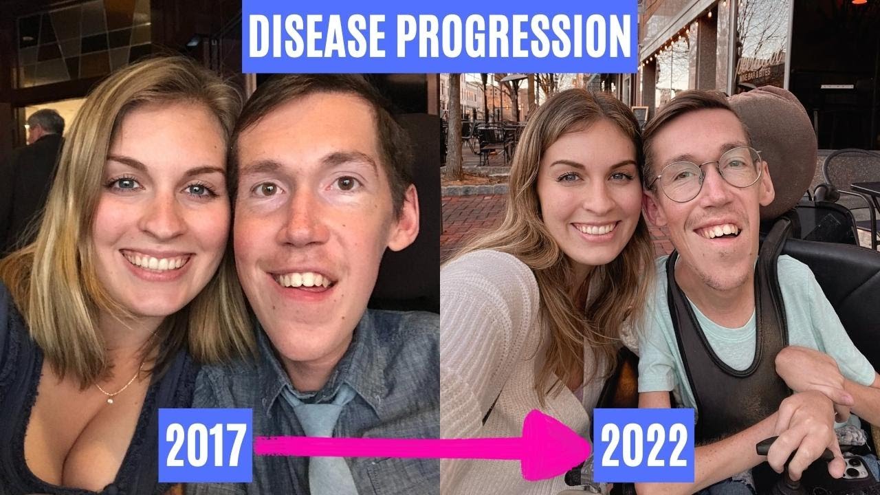 Has Shane’s disease stopped progressing?