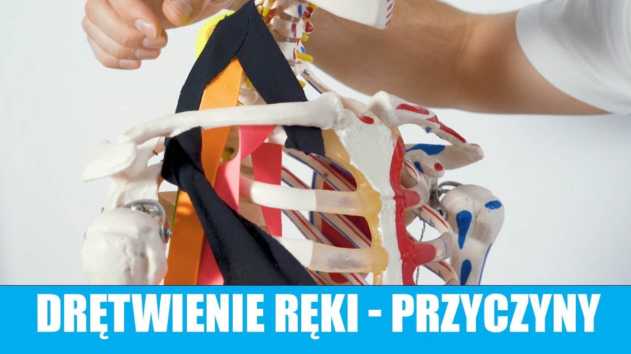 👨🏻‍⚕️ Drętwienie ręki - przyczyny | Pan Kręgosłup #10