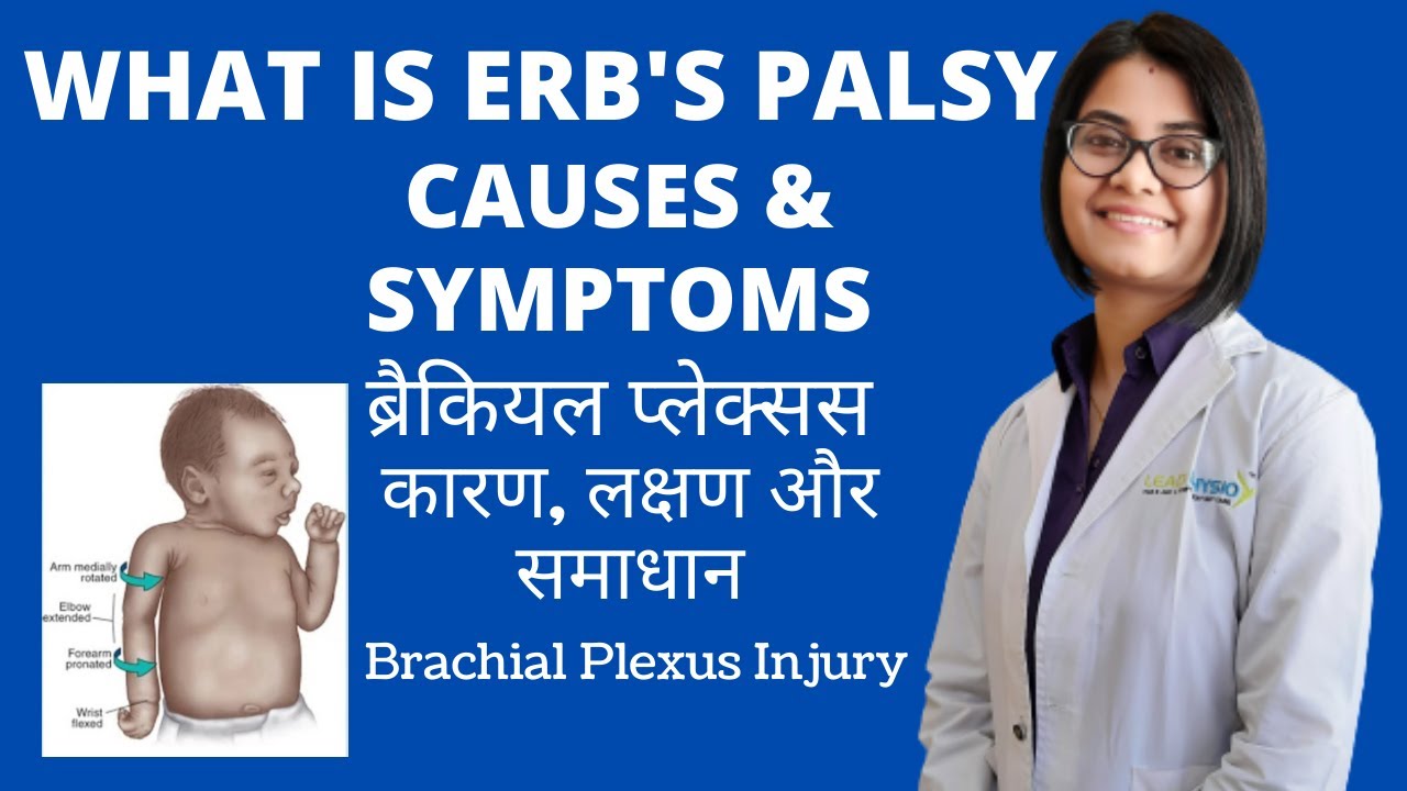 Video #1 WHAT IS ERB'S PALSY, CAUSES & SYMPTOMS IN HINDI | ब्रैकियल प्लेक्सस कारण, लक्षण & समाधान