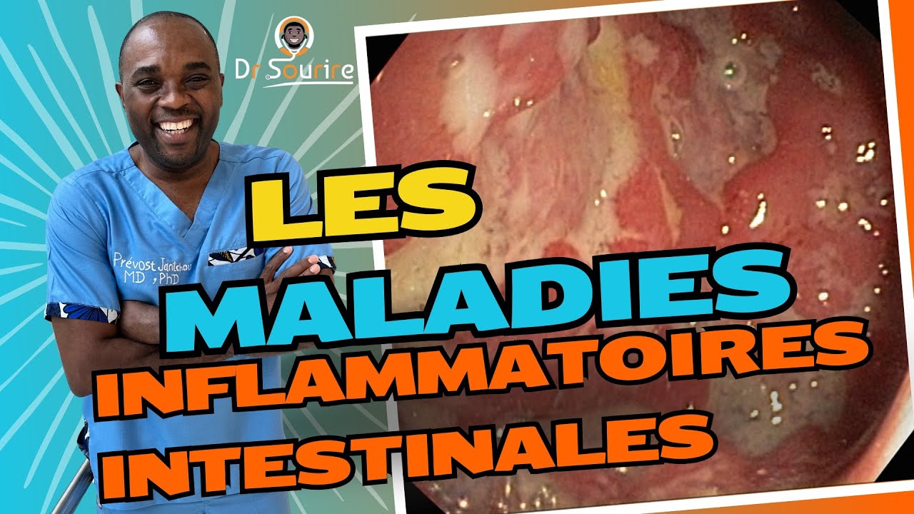 Maladie de Crohn  et Colite ulc&eacute;reuse: De A &agrave; Z tout ce que vous devez savoir