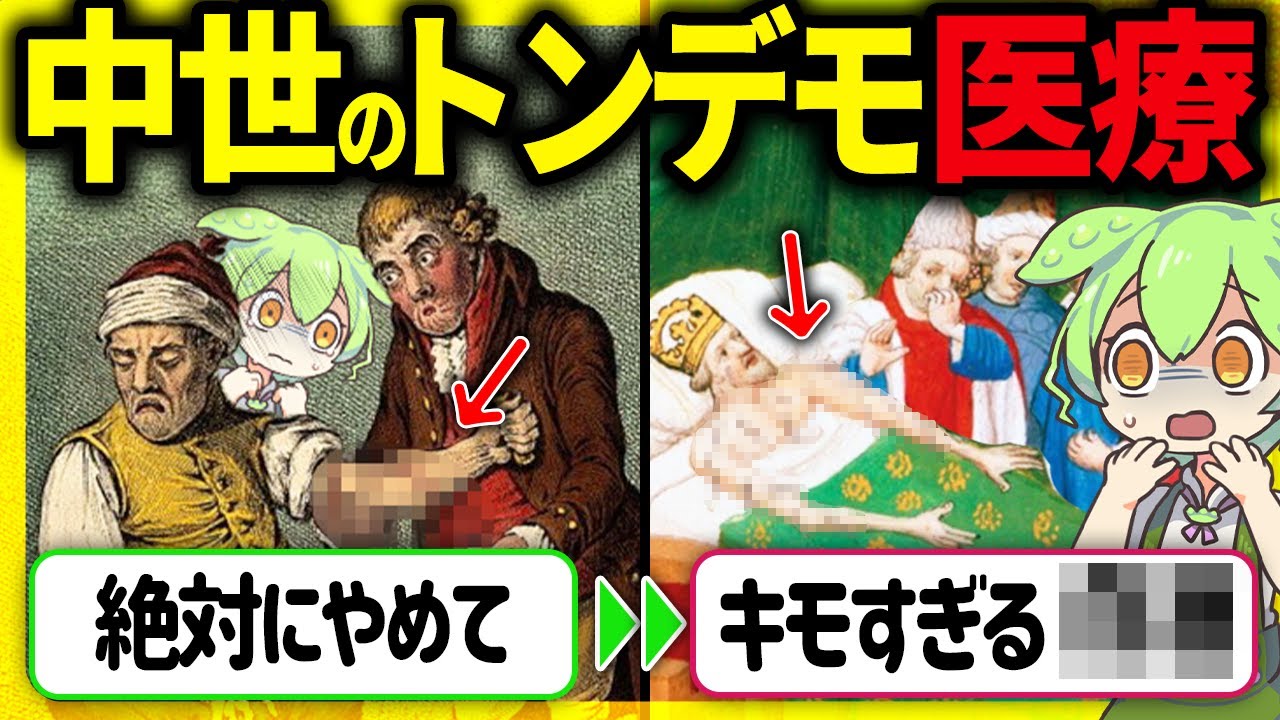 【狂気200%】発想がヤバすぎる！中世ヨーロッパの医療手術がトンデモない件とその末路【ずんだもん＆ゆっくり解説】