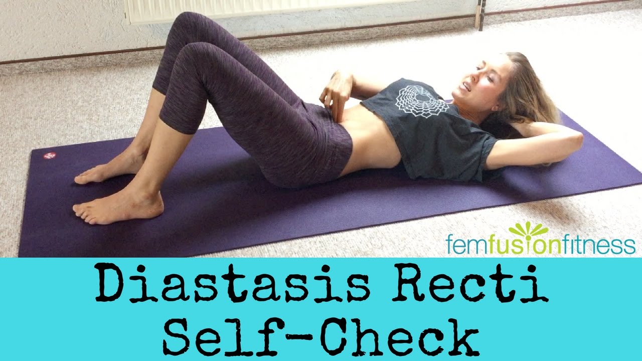 How To Test for Diastasis Recti