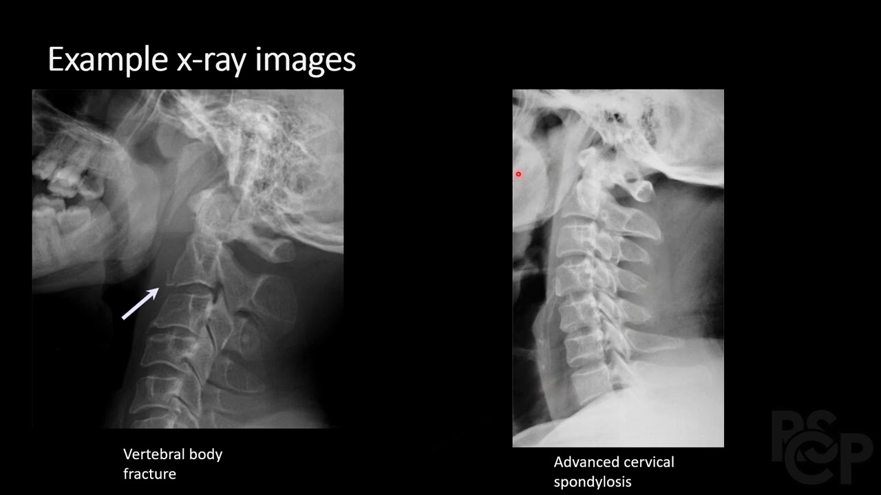 Spine Imaging