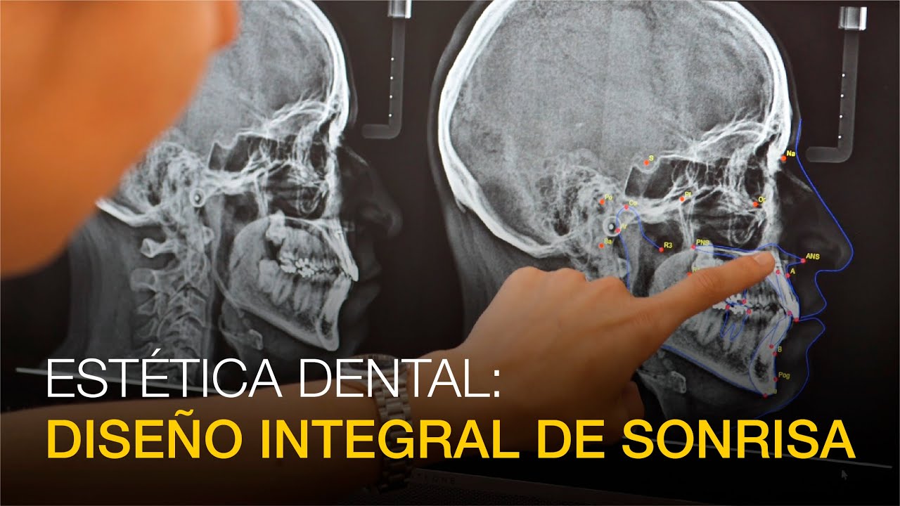 Ortodoncia y estética dental: Diseño integral de sonrisa