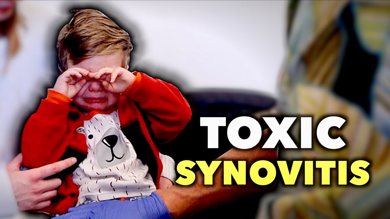 HE HAS TOXIC SYNOVITIS! (What to Know & How to Spot It in Kids) | Dr. Paul
