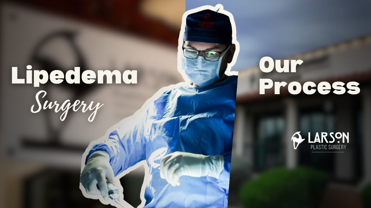 Lipedema Surgery Process | Larson plastic Surgery