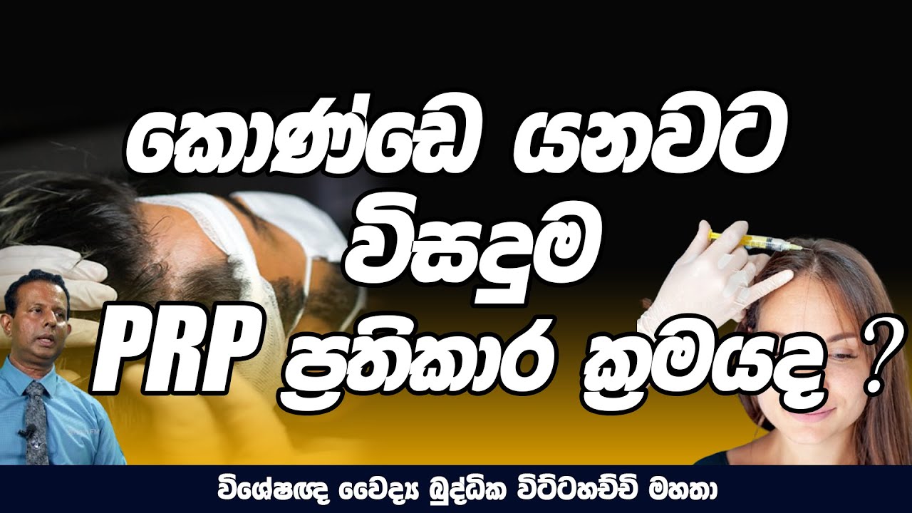 කොණ්ඩෙ යනවට විසදුම PRP Treatment එකද | Dr, Wittahachchi | NETH FM | TALK WITH DOCTOR