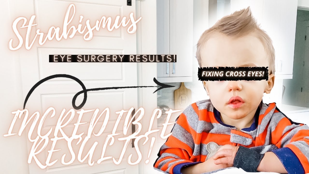 BECKHAMS NEW EYES REVEAL! EYE SURGERY RECOVERY FOR OUR BABY!