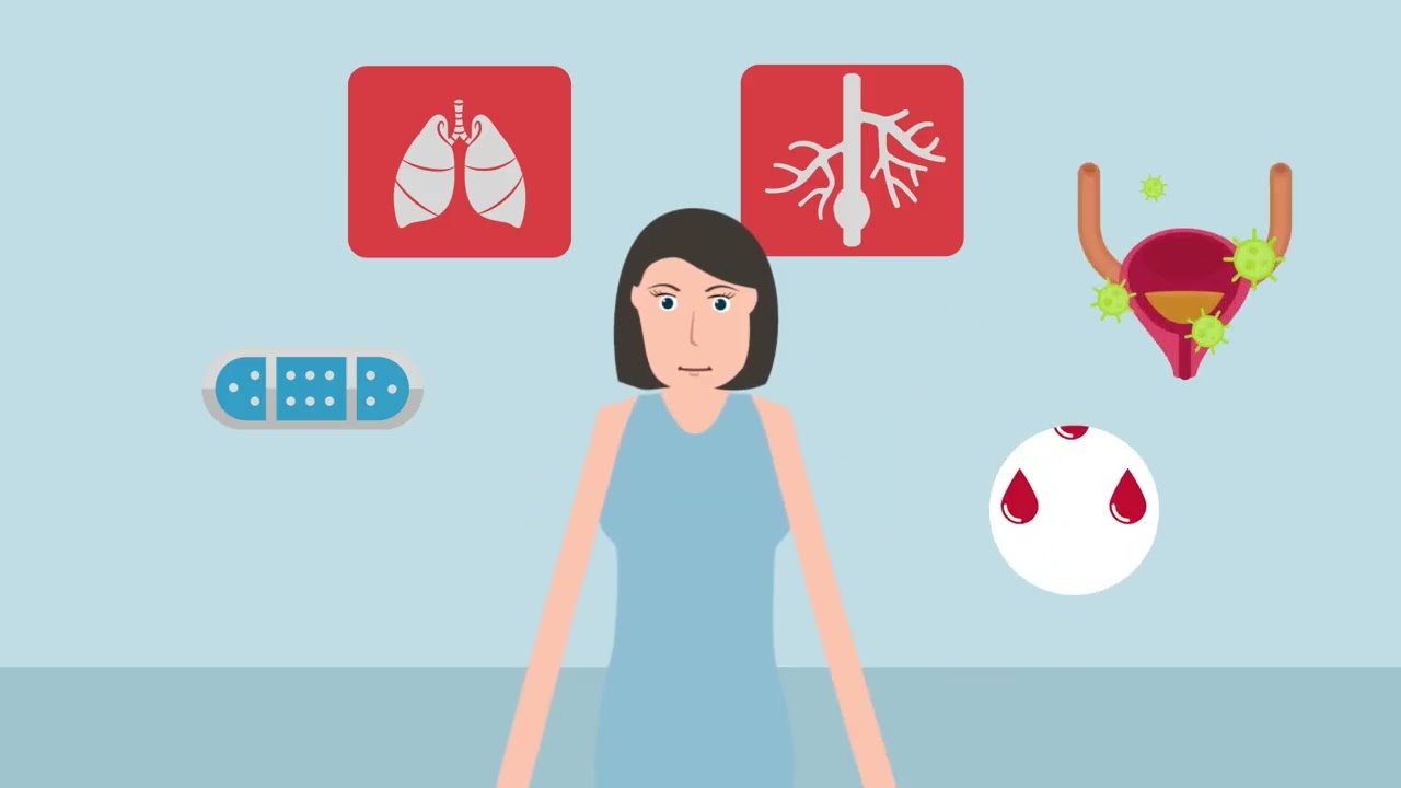 ¿Cuáles son las consecuencias y riesgos que acarrea donar un riñón en vida?