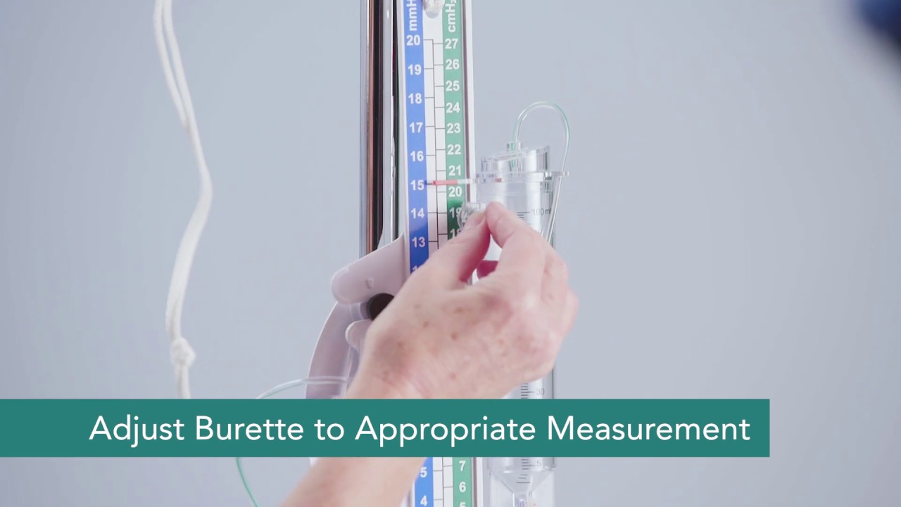 Natus EDS 3 In-Service Chapter 6: Setting the Height of the Burette
