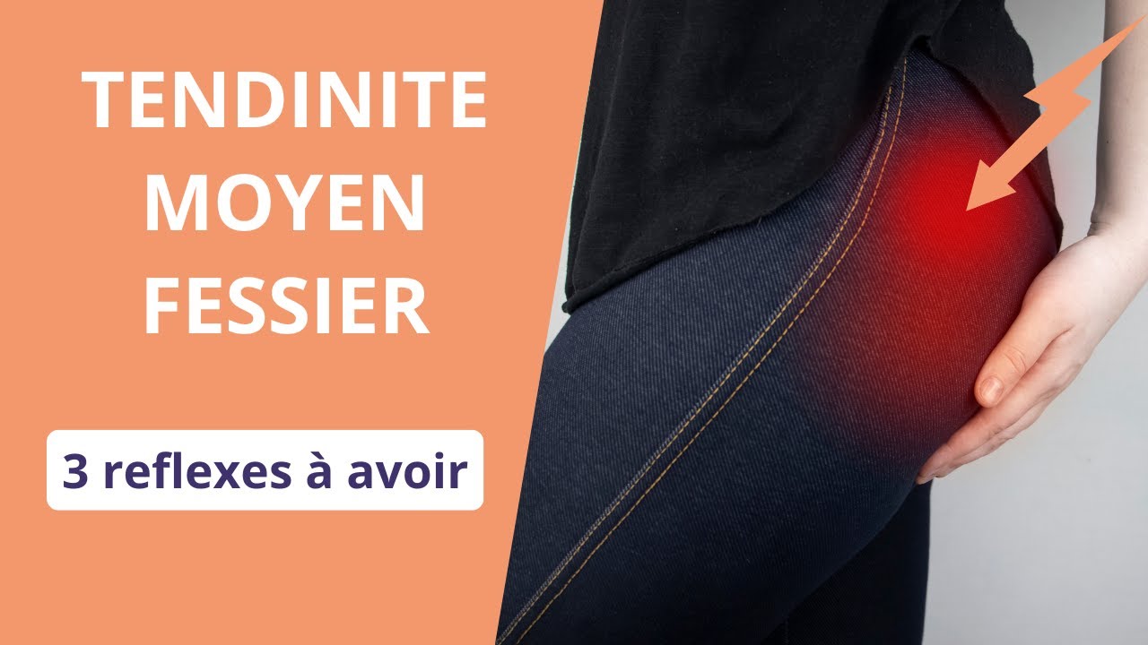 Tendinite du moyen fessier : exercices pour soulager la douleur efficacement