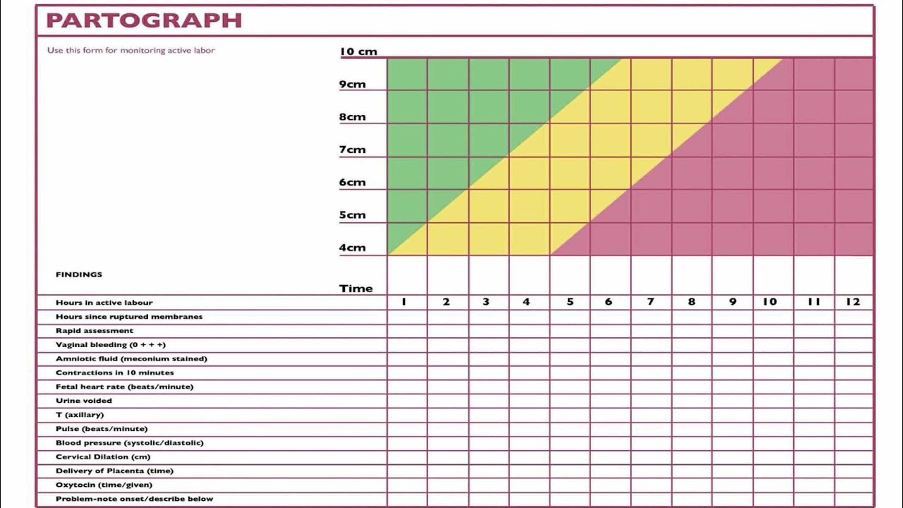 RETURN DEMONSTRATION ON PARTOGRAPH