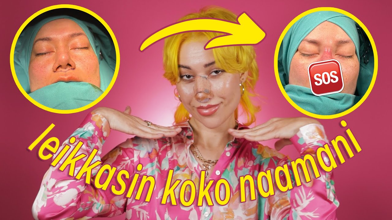 Kävin uudessa nenäleikkauksessa, lipliftissä ja luomileikkauksessa | Turkki vlog