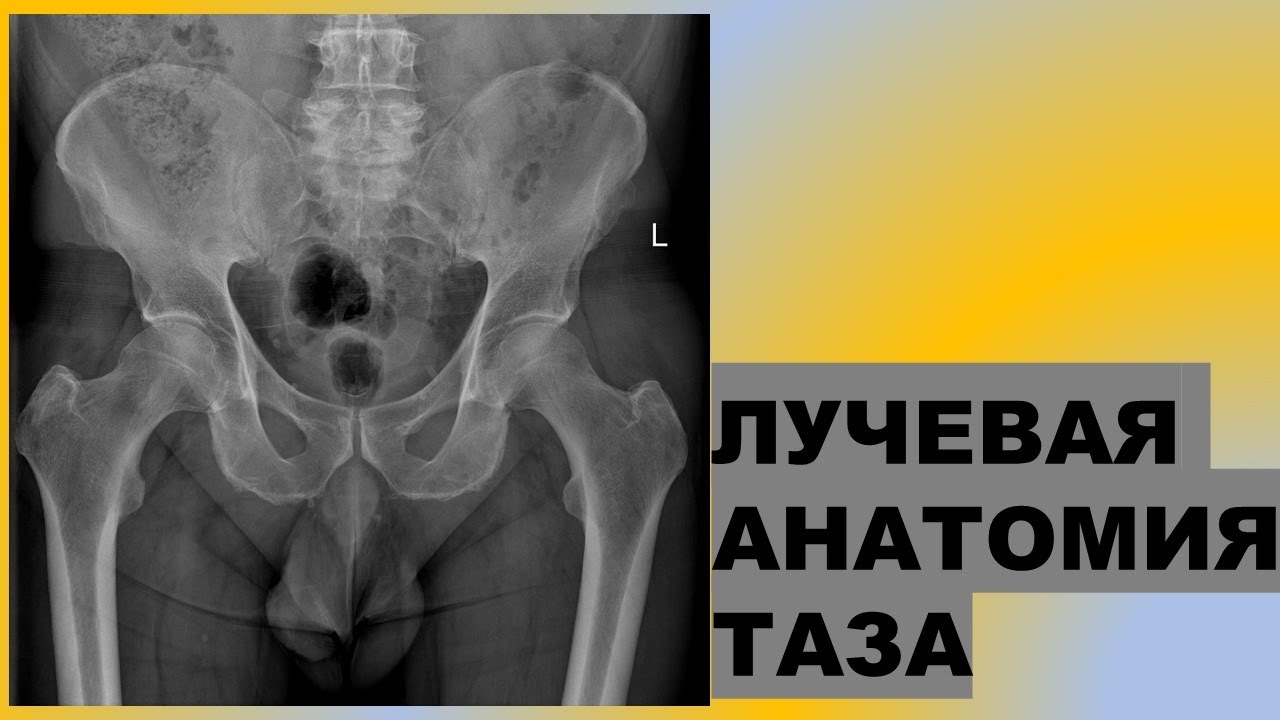 Лучевая анатомия таза | Как выглядит таз на рентгенограмме