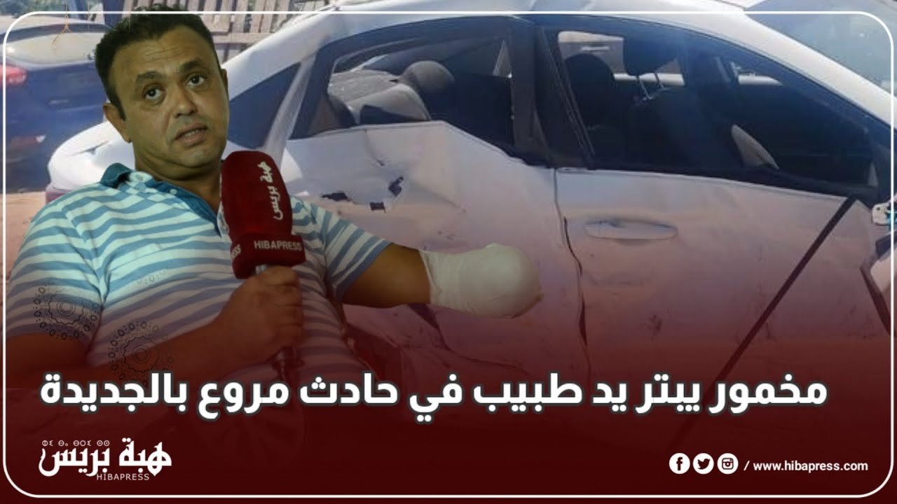 حزين..أول طبيب إختصاصي في جراحة الدماغ بالجديدة يفقد يده بسب سائق مخمور
