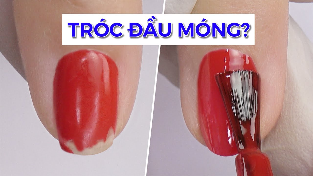 Sơn Gel Hay Bị Tróc Đầu Móng Là Vì Sao?? ANALIA Nails