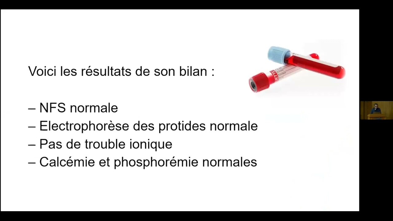 Cas cliniques sur l'ostéoporose