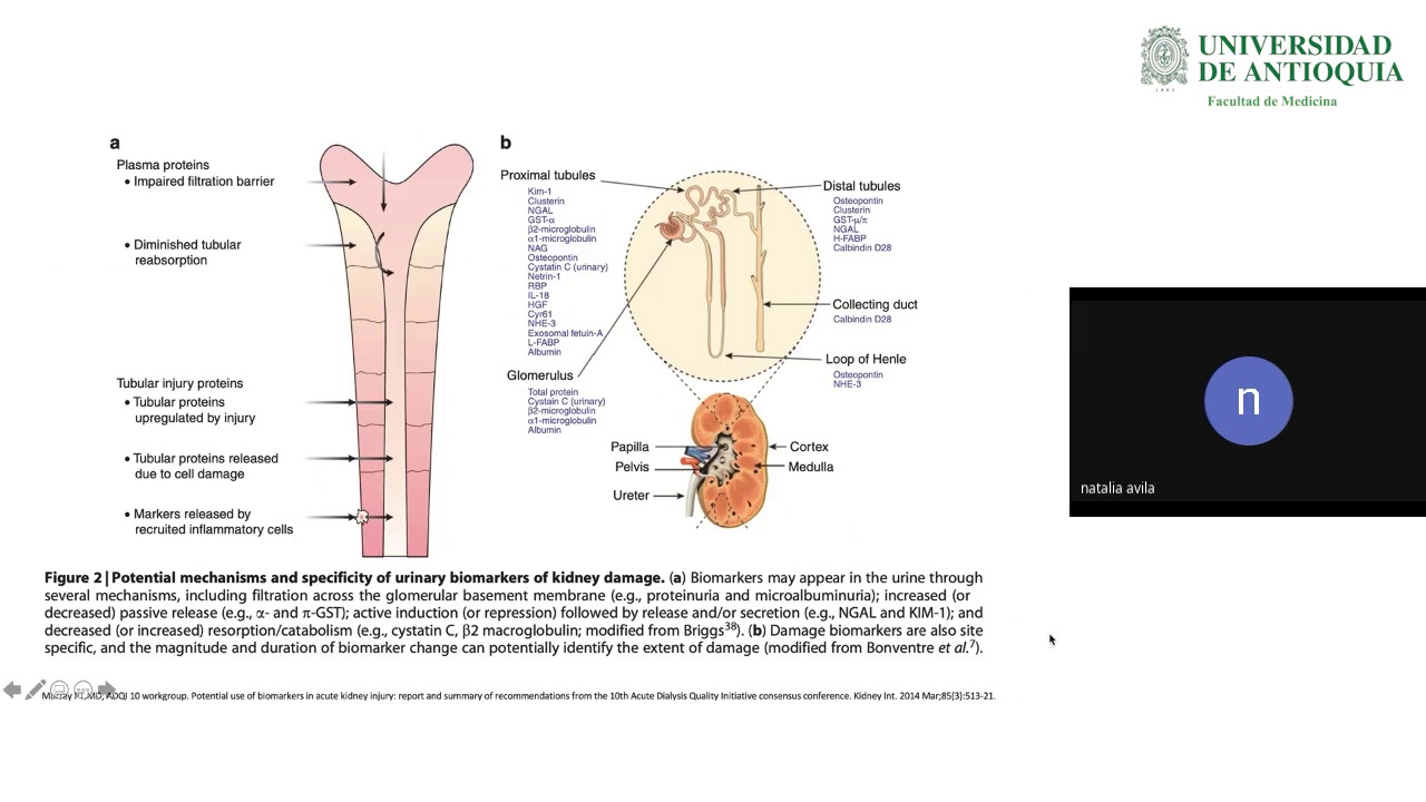 Biomarcadores en Lesi&oacute;n Renal Aguda - Dra. Natalia &Aacute;vila