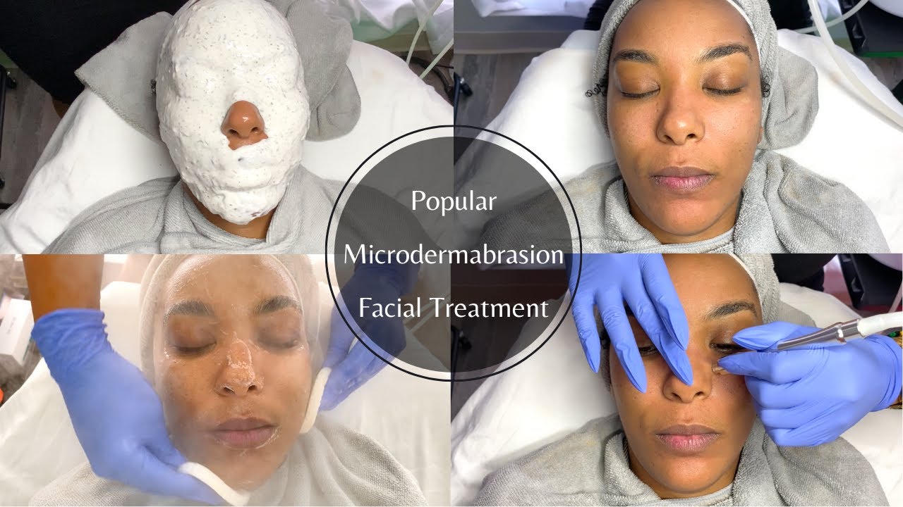 Popular Microdermabrasion Facial Treatment