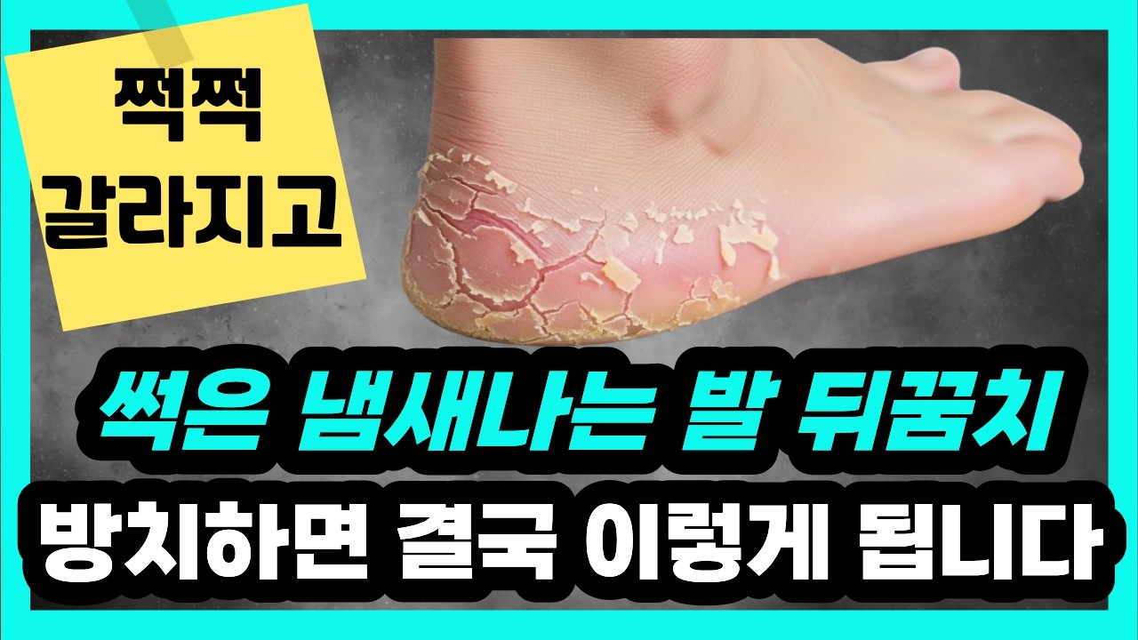 쩍쩍 갈라지고 냄새나는 발, 방치하면 큰일납니다! (집에서 끝내는 아기발 솔루션)